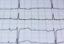 vortex business operations center